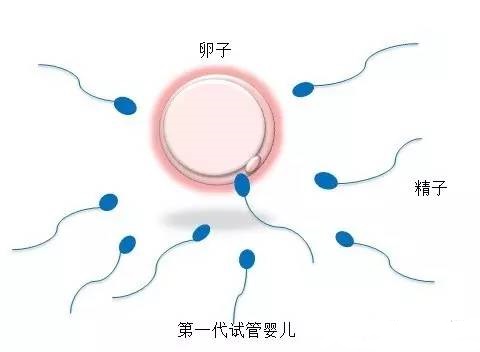 代生选性别供卵代生医院